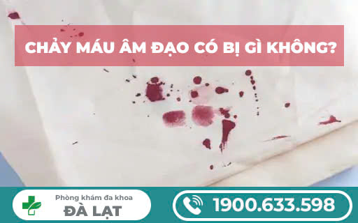 Hình ảnh minh họa